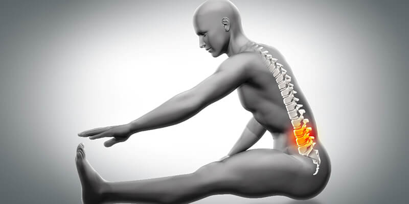 Por qué me duele la espalda: artrosis lumbar